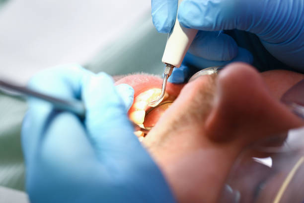 Best Emergency Gum Treatment in Donalsonville, GA